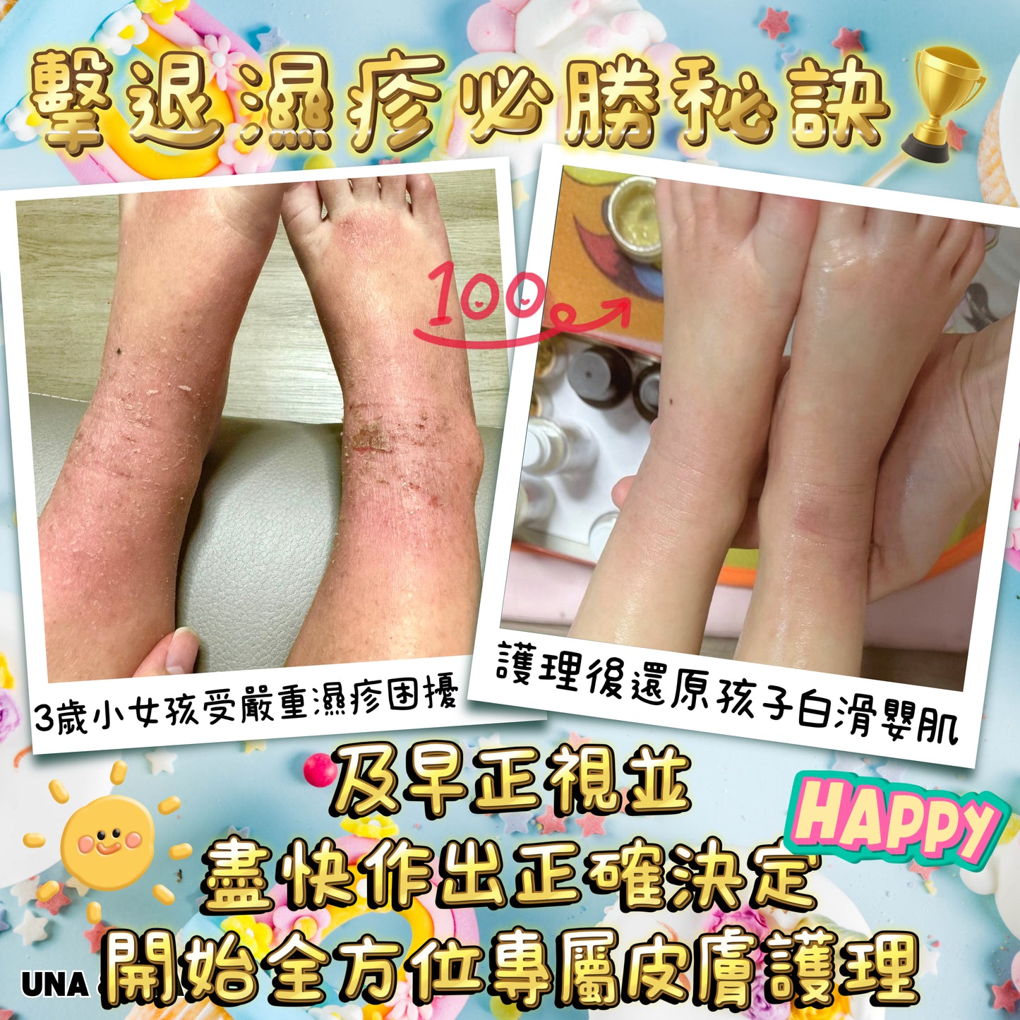 印度苦楝速效止痕乳液(嬰幼兒適用)- Step1