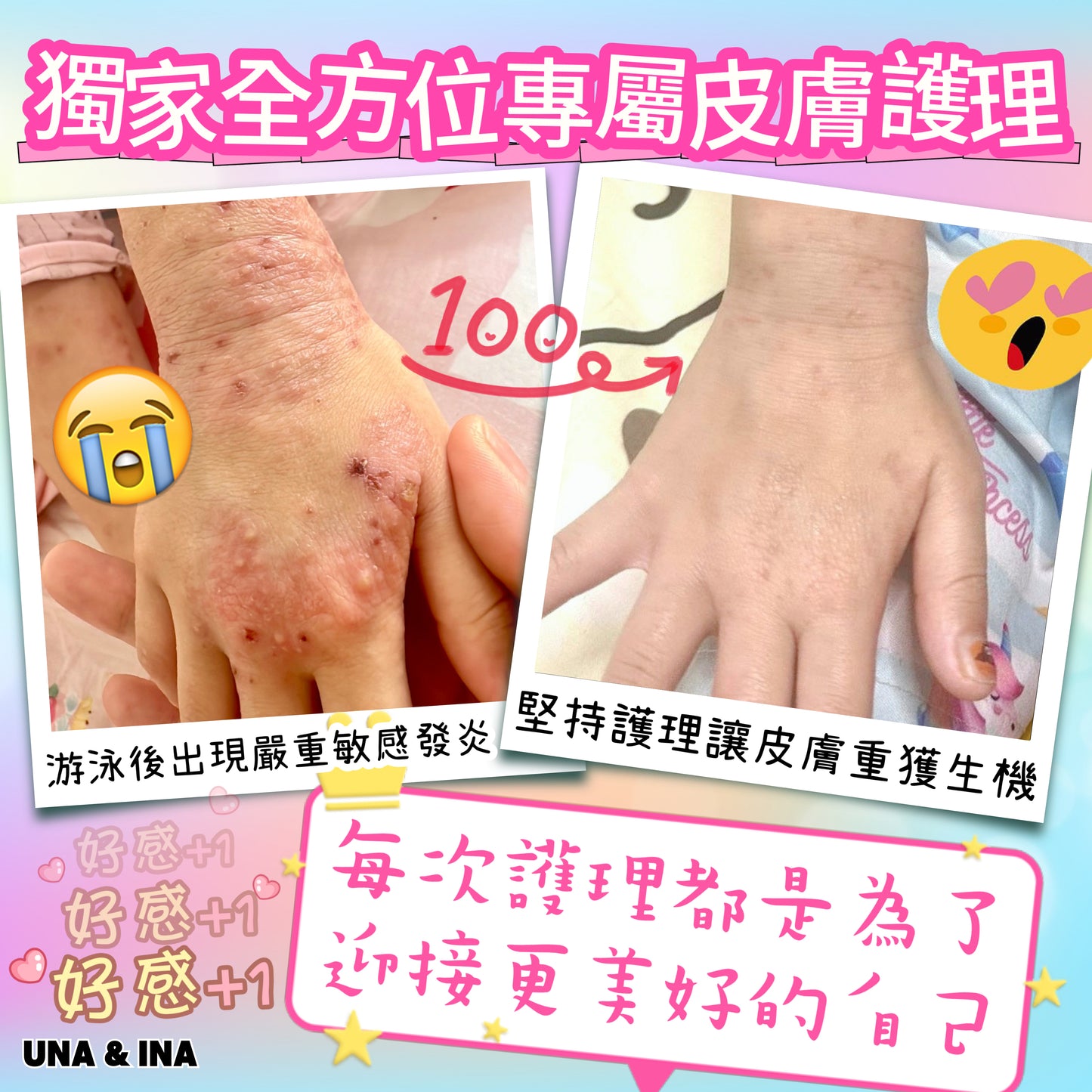 印度苦楝速效止痕乳液(嬰幼兒適用)- Step1