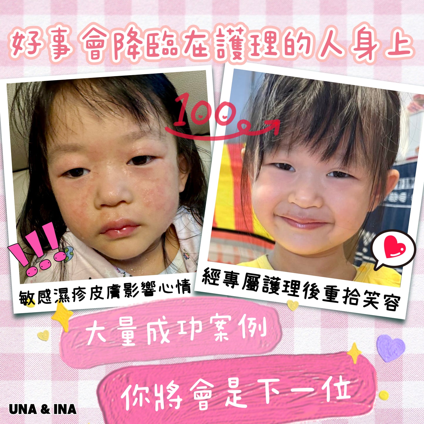 印度苦楝速效止痕乳液(嬰幼兒適用)- Step1