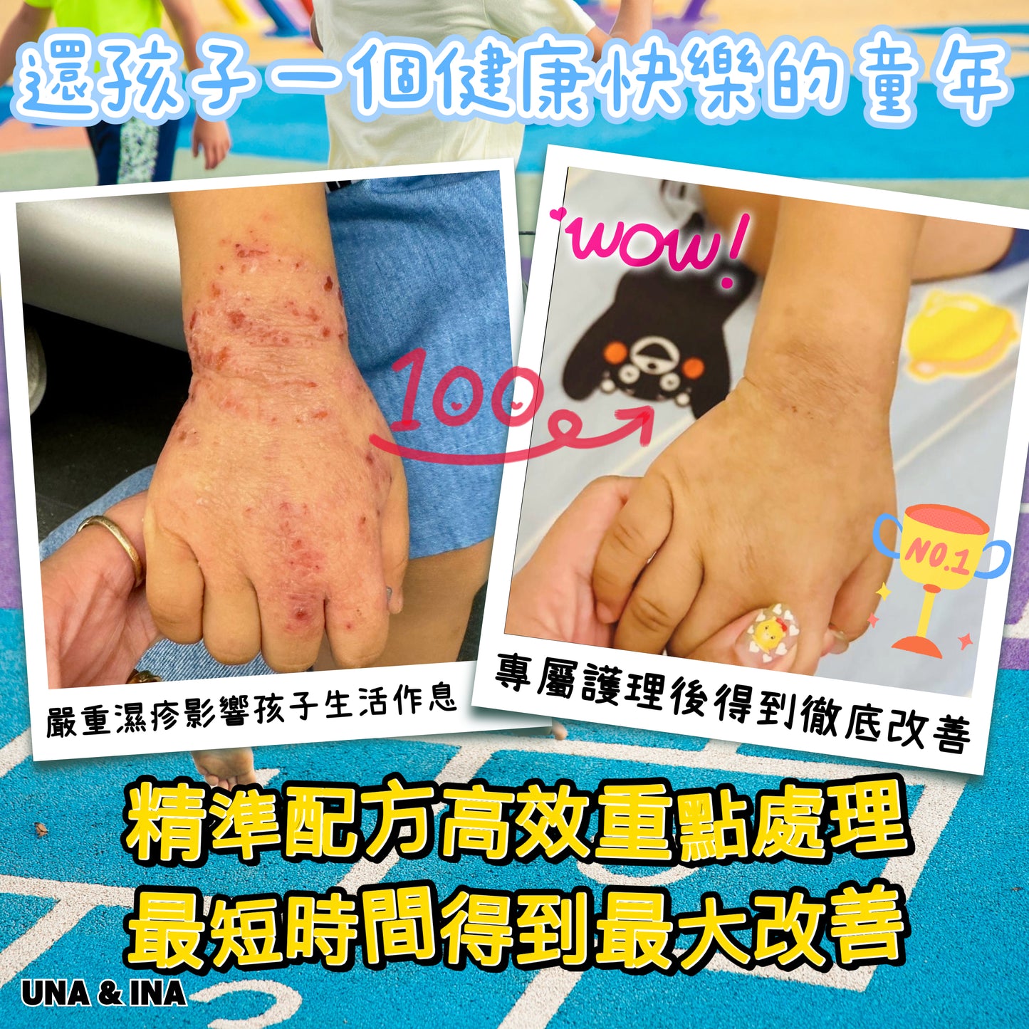 印度苦楝速效止痕乳液(嬰幼兒適用)- Step1
