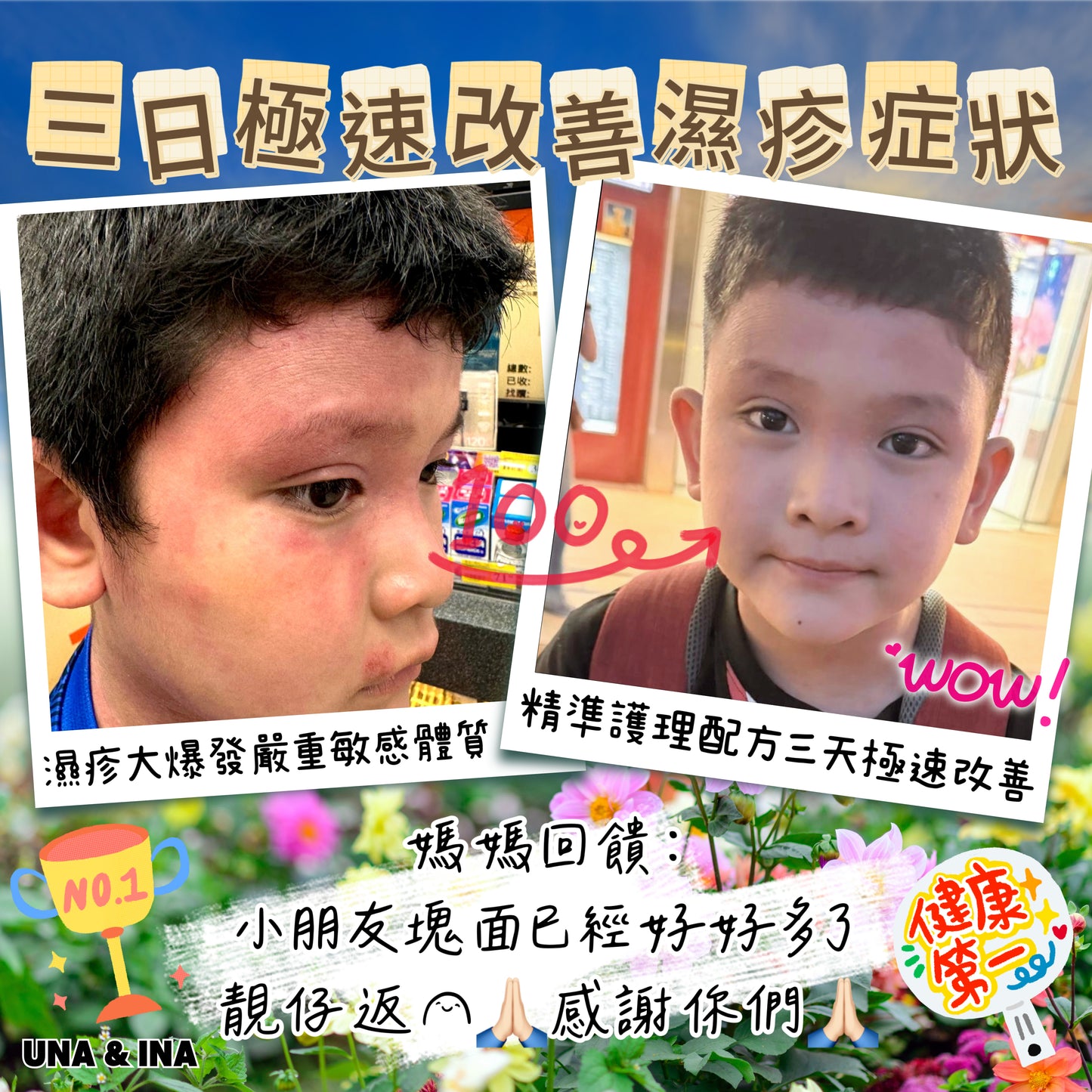 印度苦楝速效止痕乳液(嬰幼兒適用)- Step1
