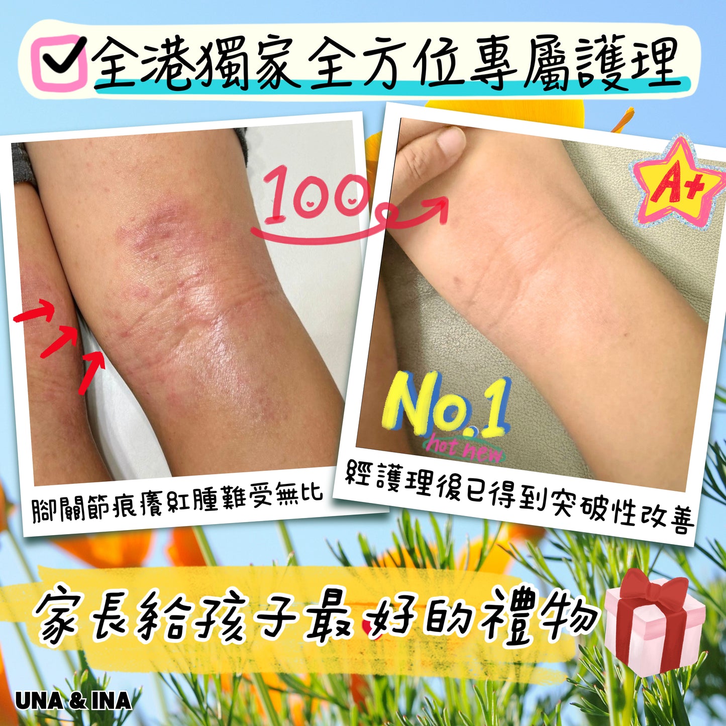 印度苦楝速效止痕乳液(嬰幼兒適用)- Step1