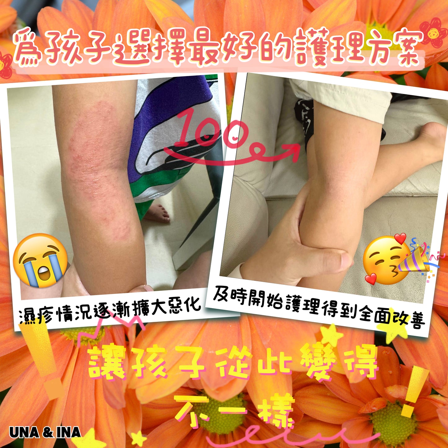 印度苦楝速效止痕乳液(嬰幼兒適用)- Step1