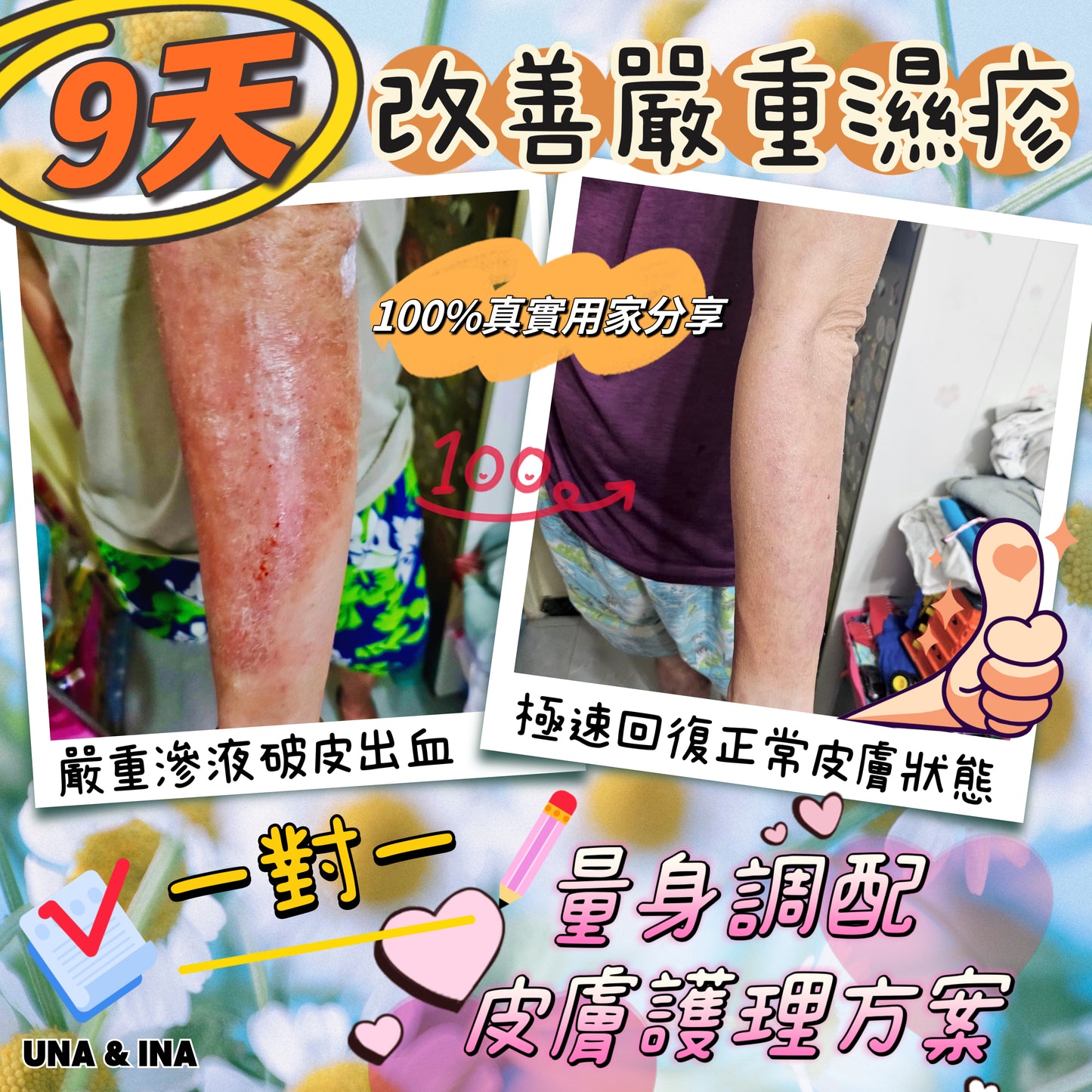 全方位濕疹護理七步曲優惠套裝